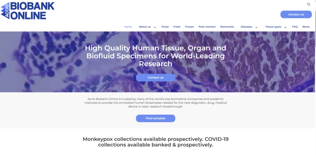 进了美国“斩杀线”,流浪汉当场变“高达零件”?